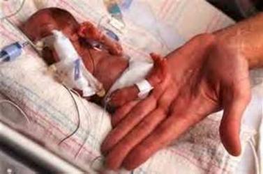 image010_premature