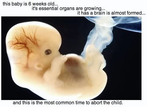 itsachild__6wk_baby